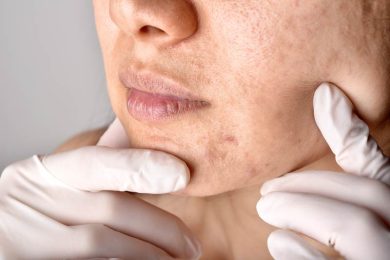 Doctor touching patient face during skin cancer exam